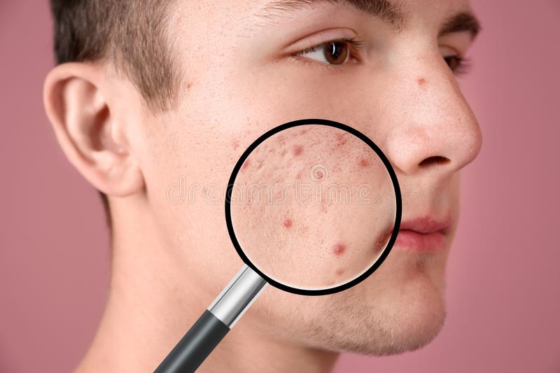 common skin problem of men shown