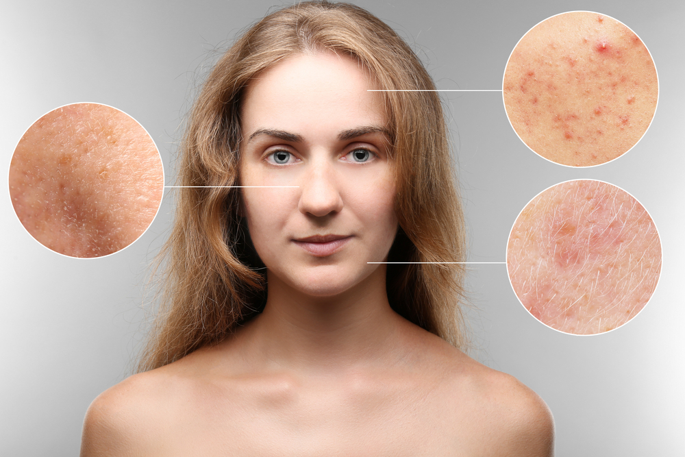 Skin problems a woman may face has been shown in the picture.